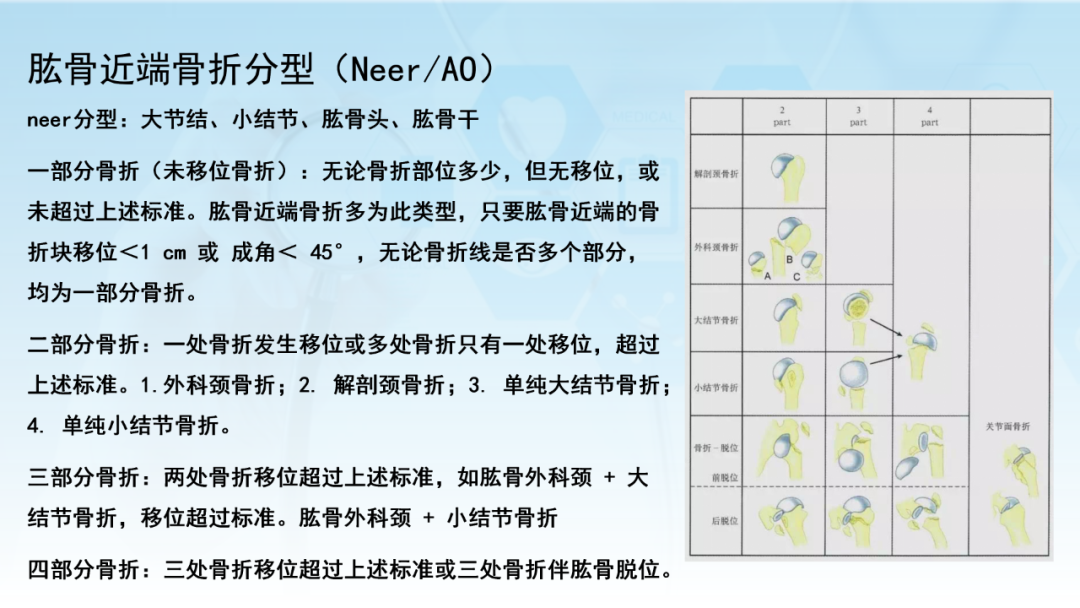 骨水泥辅助技术在骨质疏松性肱骨近端骨折中的应用探索