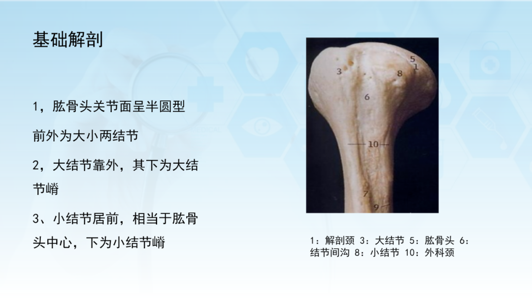 骨水泥辅助技术在骨质疏松性肱骨近端骨折中的应用探索