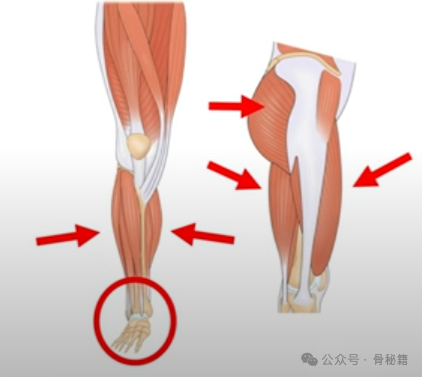 髌骨软化，到底哪里软了？