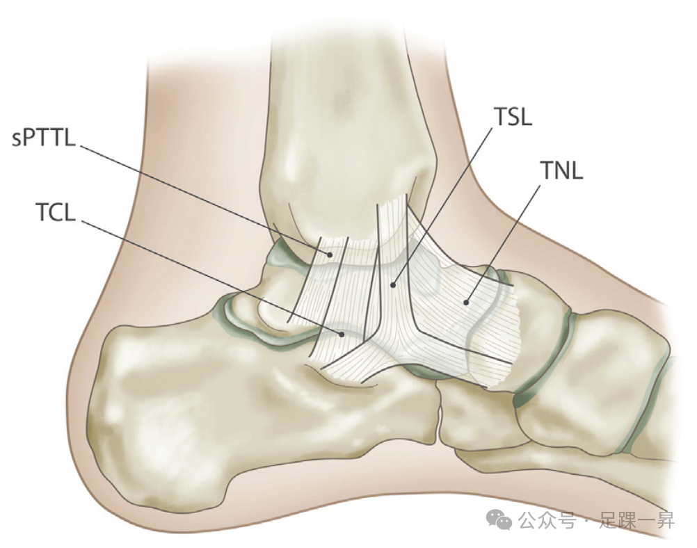 踝关节骨折：急性三角韧带断裂锚钉修复技术