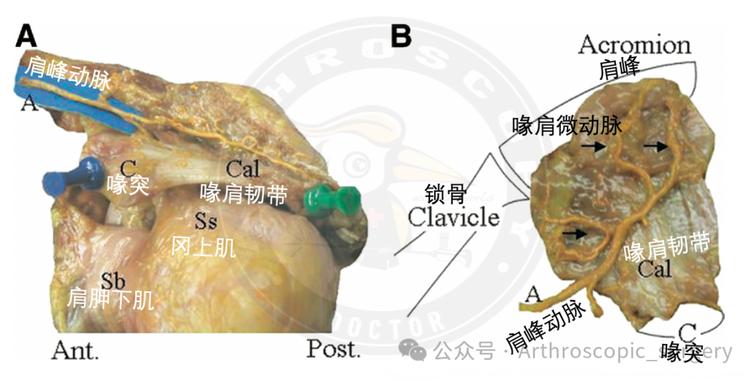 【手术技术】肩峰下周围血管的解剖