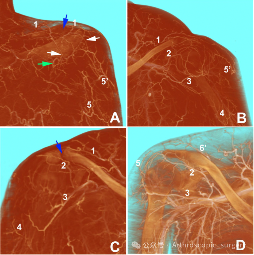 【手术技术】肩峰下周围血管的解剖