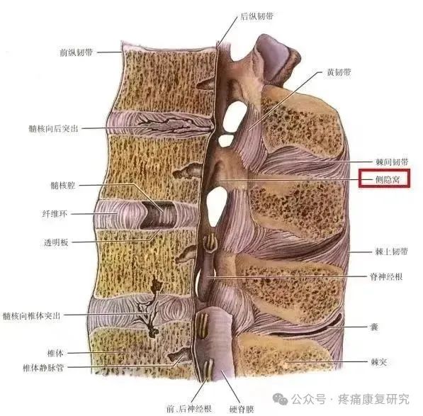 侧隐窝狭窄的详细解剖和诊疗