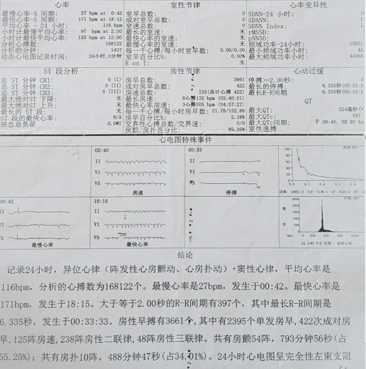 “小胶囊，大作用”——从一个病例认识Micra无导线起搏的临床应用