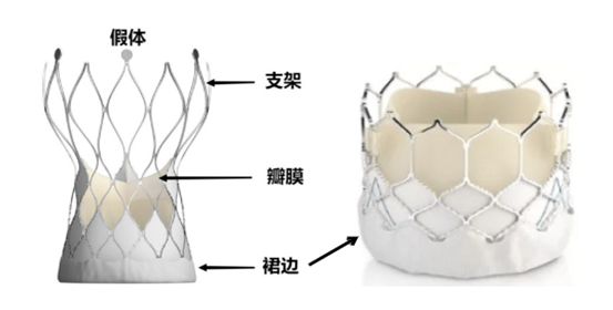 防止主动脉瓣植入发生瓣周漏，得注意这5条……