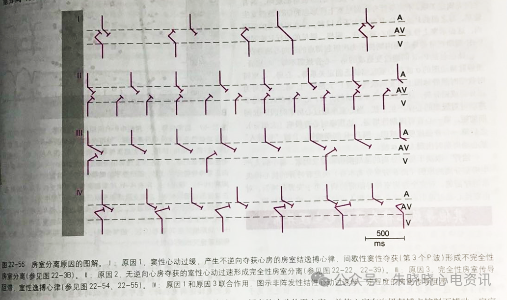 如何解读“房室分离”？