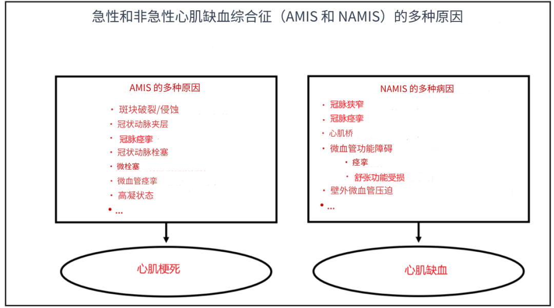 建议冠心病改名为心肌缺血综合征！Circulation和欧洲心脏杂志同期刊登文章