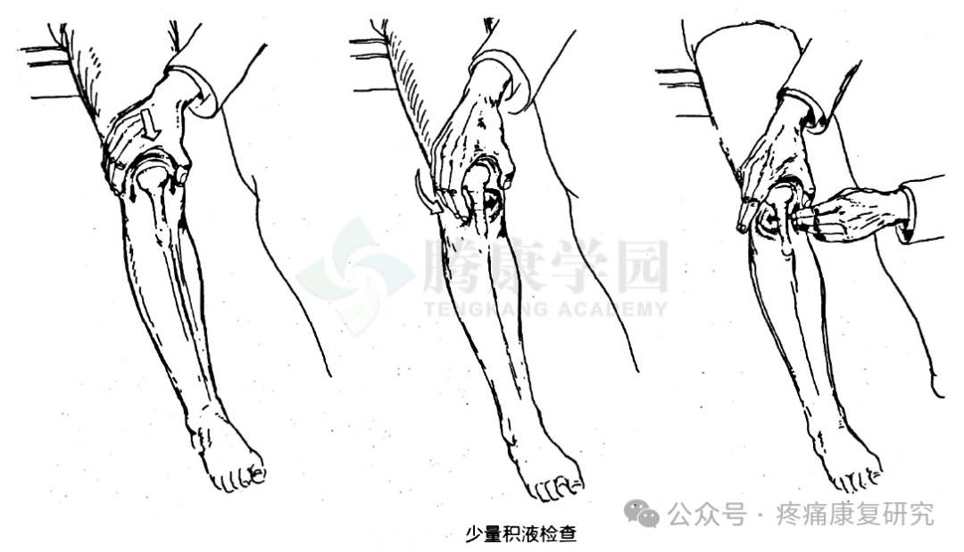 膝关节的