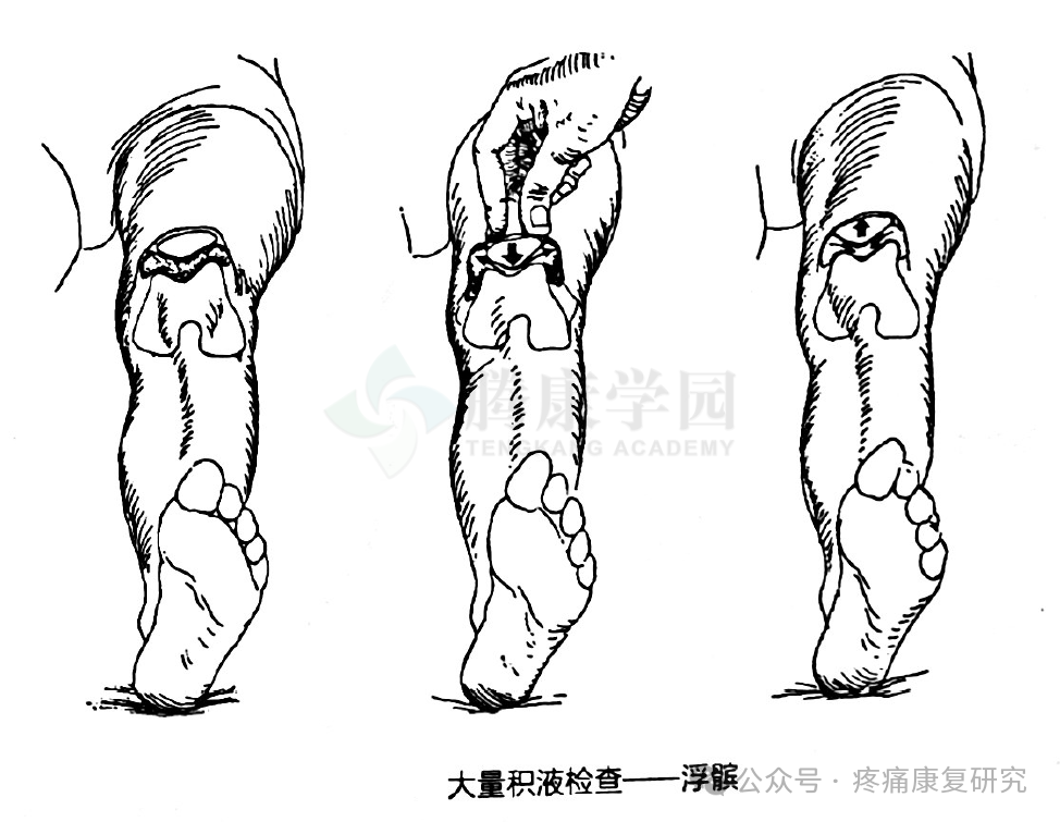 膝关节的