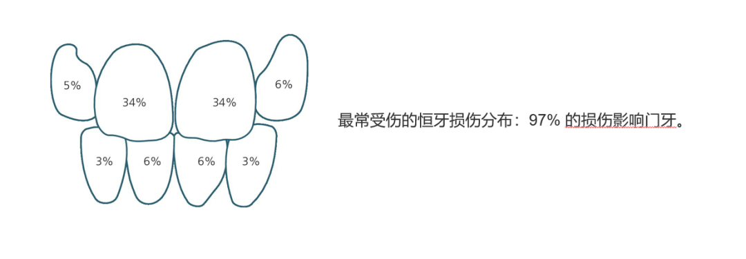 乳牙外伤的分类总结及处理办法