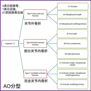 图文并茂，一文详解胫骨平台骨折的常见分型