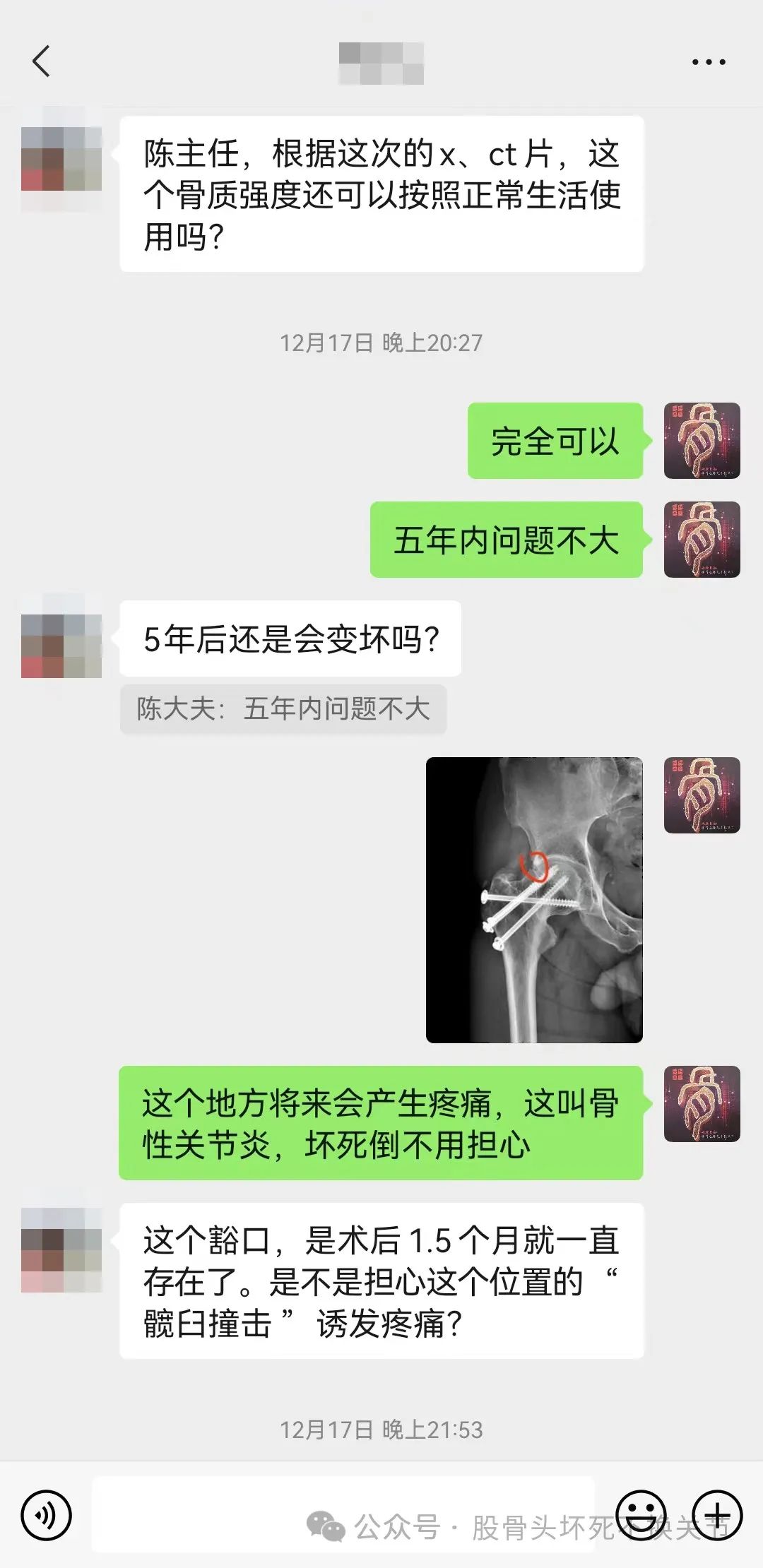 股骨颈骨折