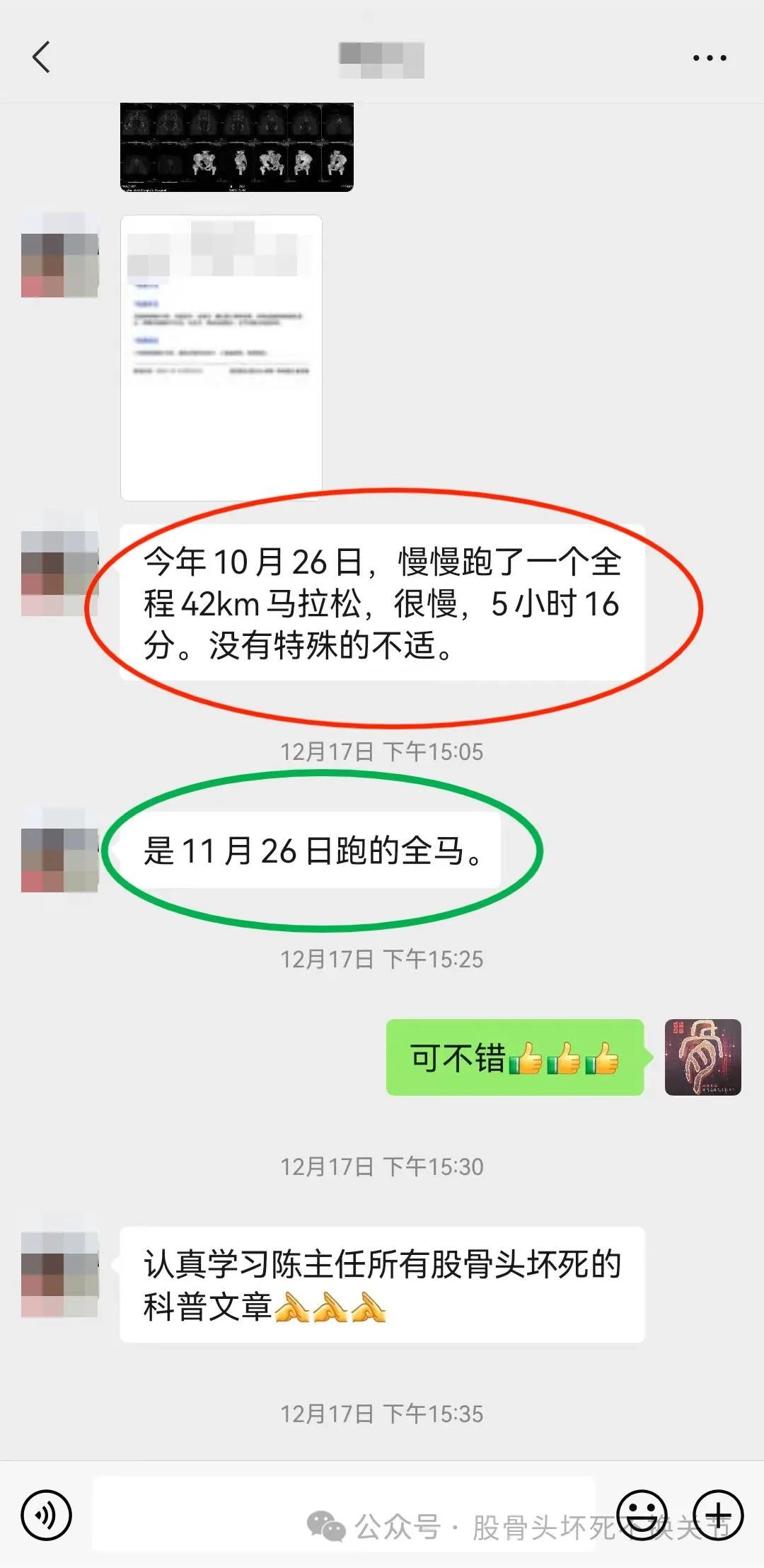 股骨颈骨折