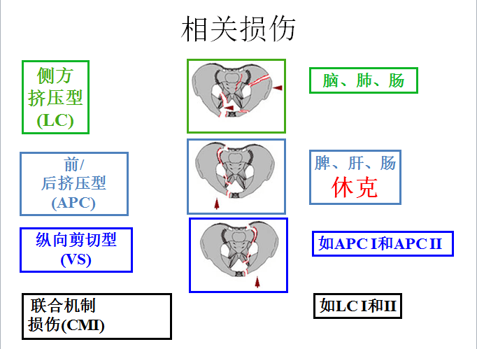 Hak博士-危及生命的骨盆骨折出血如何处理？