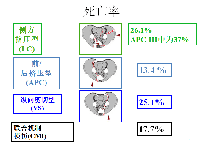 Hak博士-危及生命的骨盆骨折出血如何处理？