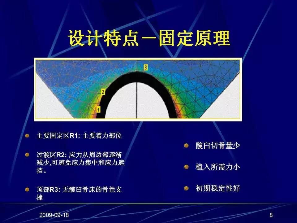 髋关节置换手术技巧及并发症的防范