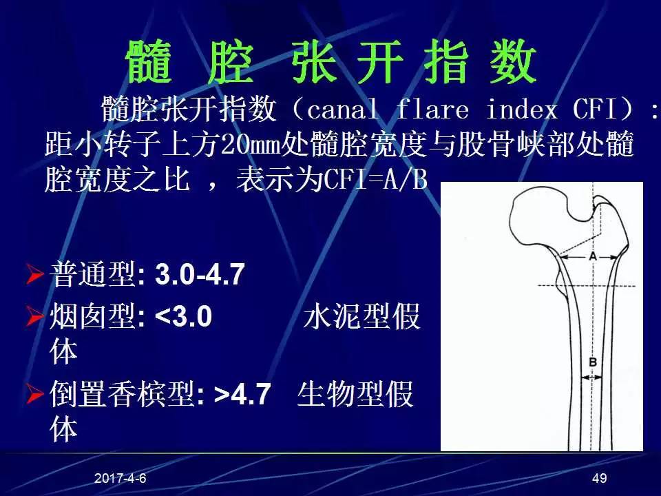 髋关节置换手术技巧及并发症的防范