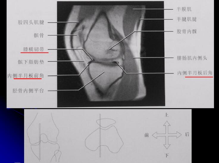 最全膝关节解剖及MRI诊断技巧