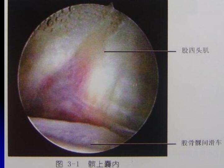 最全膝关节解剖及MRI诊断技巧