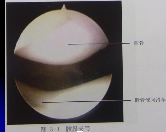 最全膝关节解剖及MRI诊断技巧