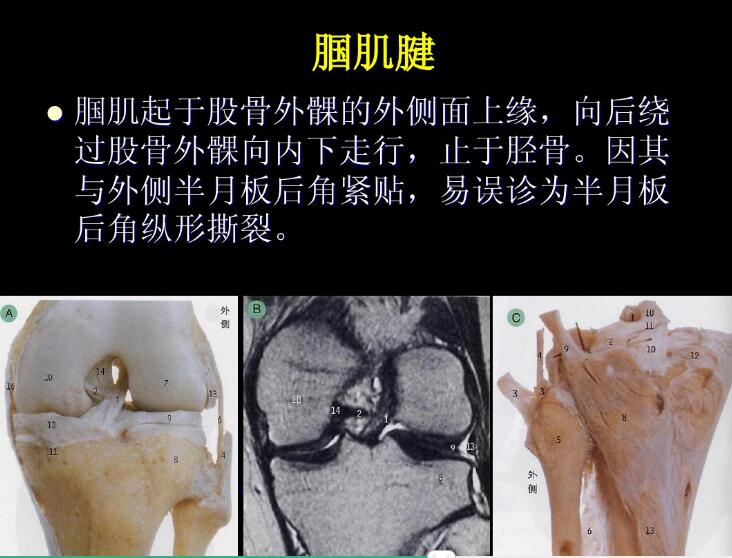 最全膝关节解剖及MRI诊断技巧