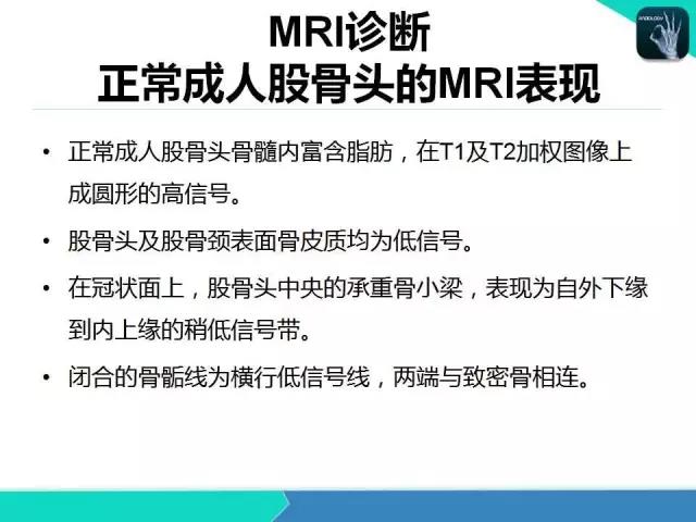 这个课件我想你需要！股骨头缺血性坏死的诊断