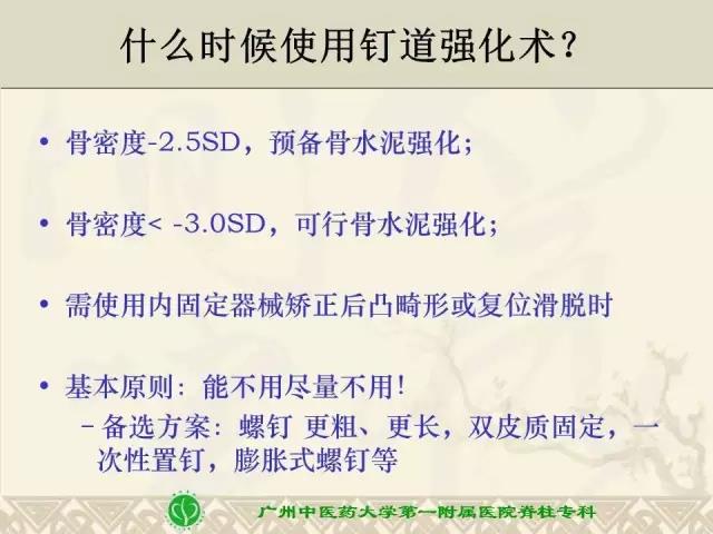 骨水泥椎弓根螺钉强化技术的安全流程