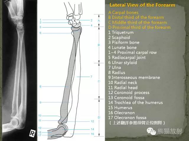 肘关节及前臂平片——临床影像示例