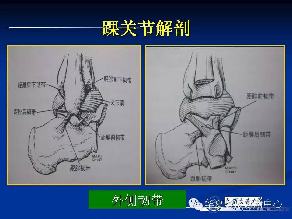 MRI在踝关节损伤中的应用