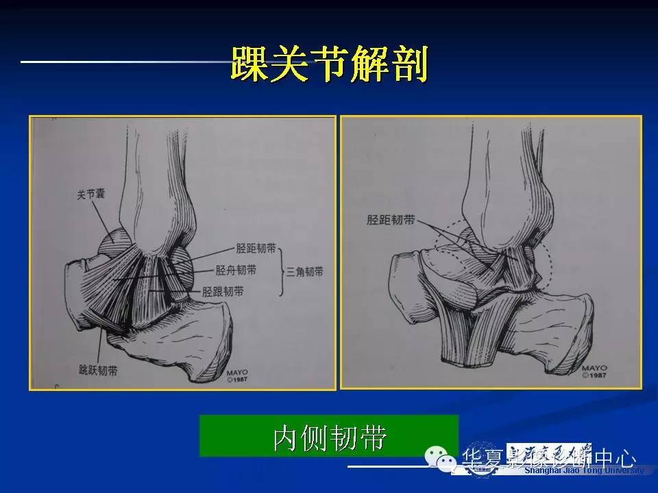 MRI在踝关节损伤中的应用