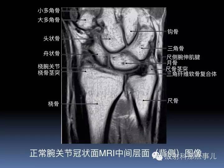 腕关节MRI检查、解剖与常见病变