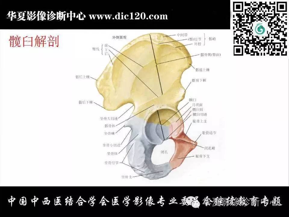 髋关节常见疾病的影像诊断