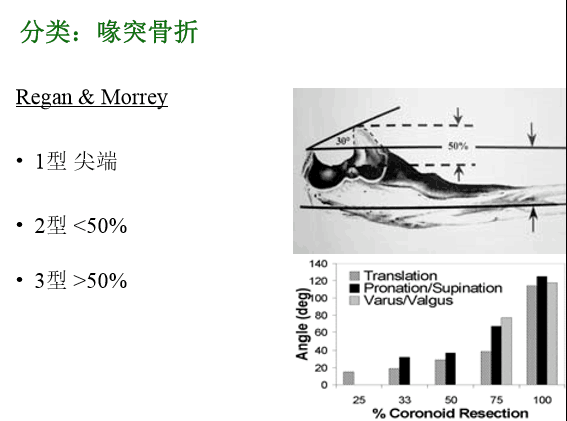 【2】荷兰最佳外科医生详细讲解“肘关节不稳定”