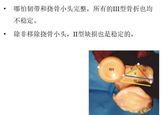 【2】荷兰最佳外科医生详细讲解“肘关节不稳定”