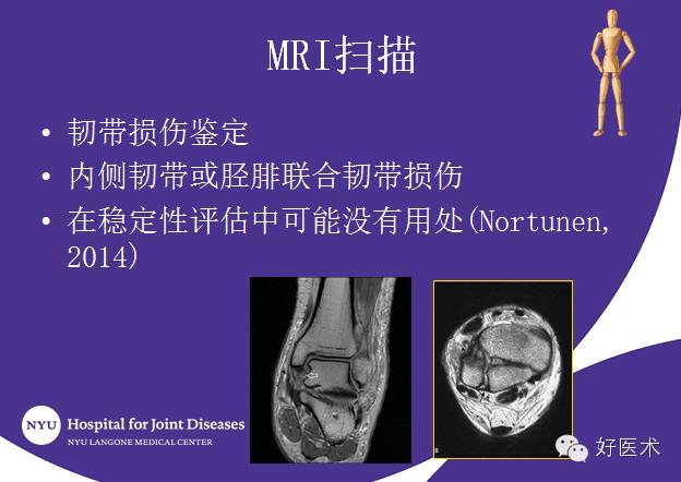 【1】国际上踝关节骨折治疗的案例分析