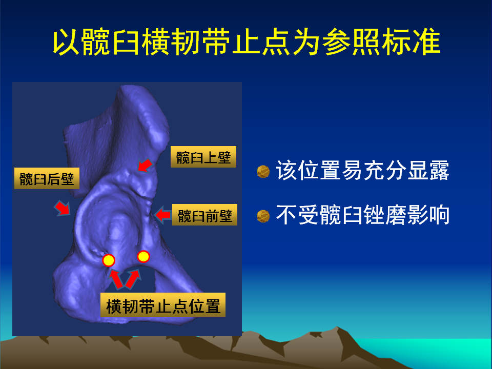 髋臼发育不良(DDH)手术策略