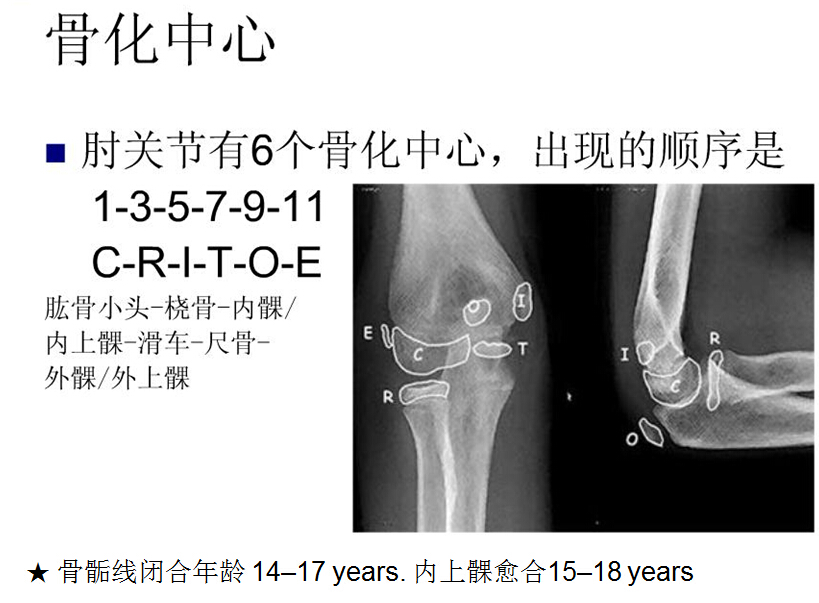 儿童肘关节骨折如何诊断？