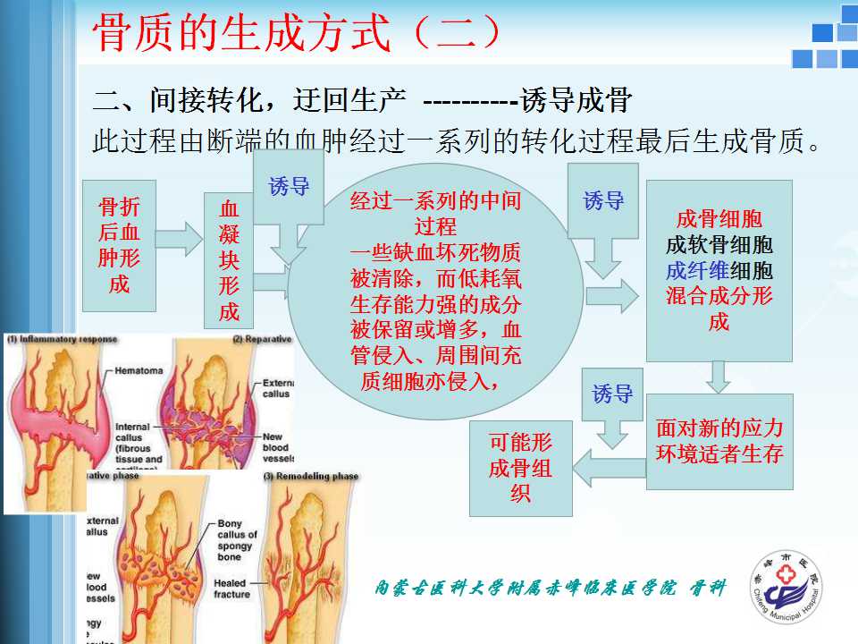 骨折愈合的原理与逻辑