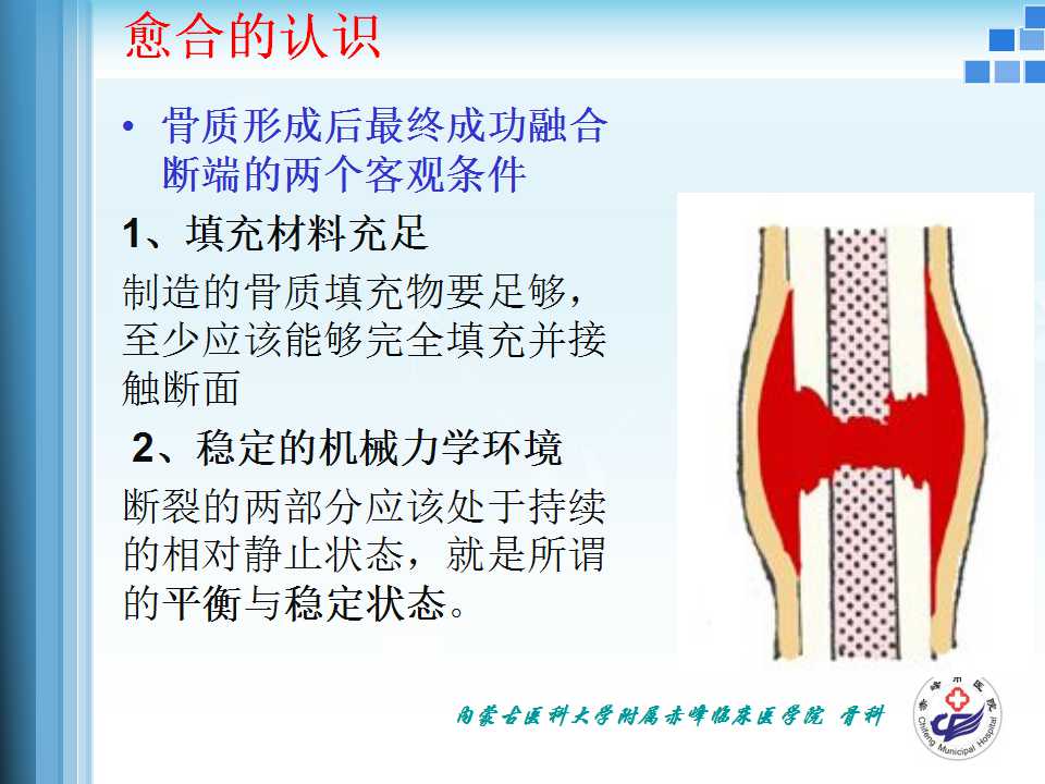 骨折愈合的原理与逻辑