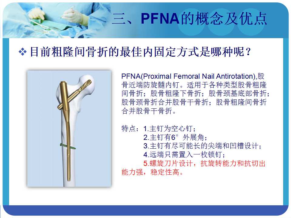 最常用的PFNA髓内钉，你真的了解吗？