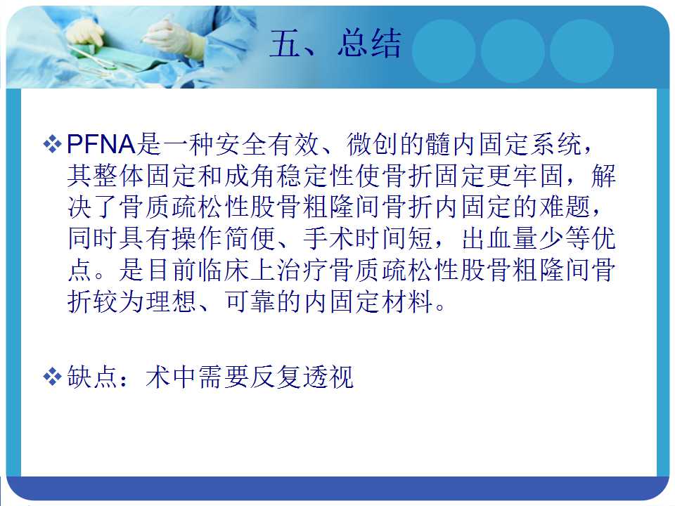 最常用的PFNA髓内钉，你真的了解吗？