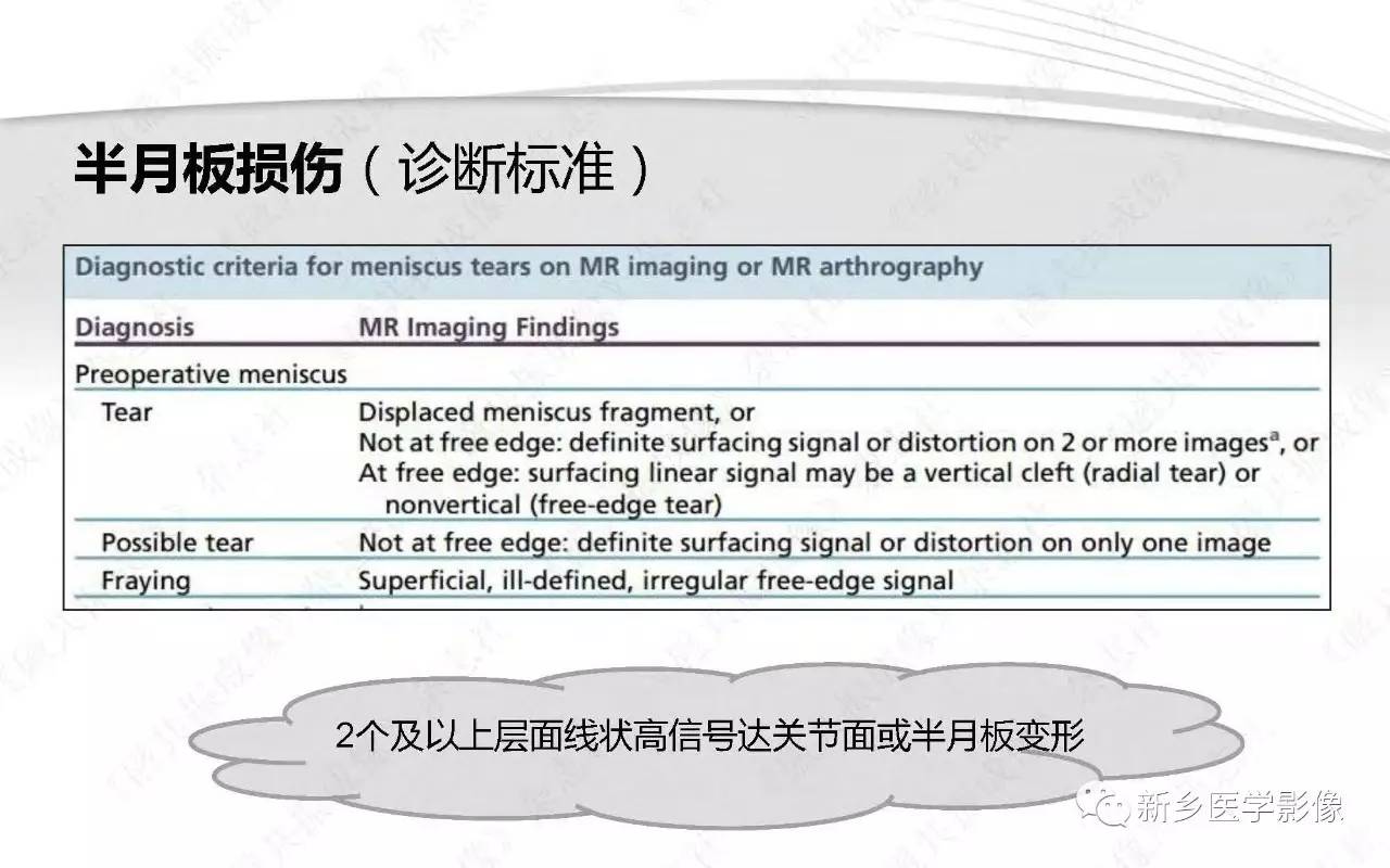 半月板损伤手术前后的MRI诊断