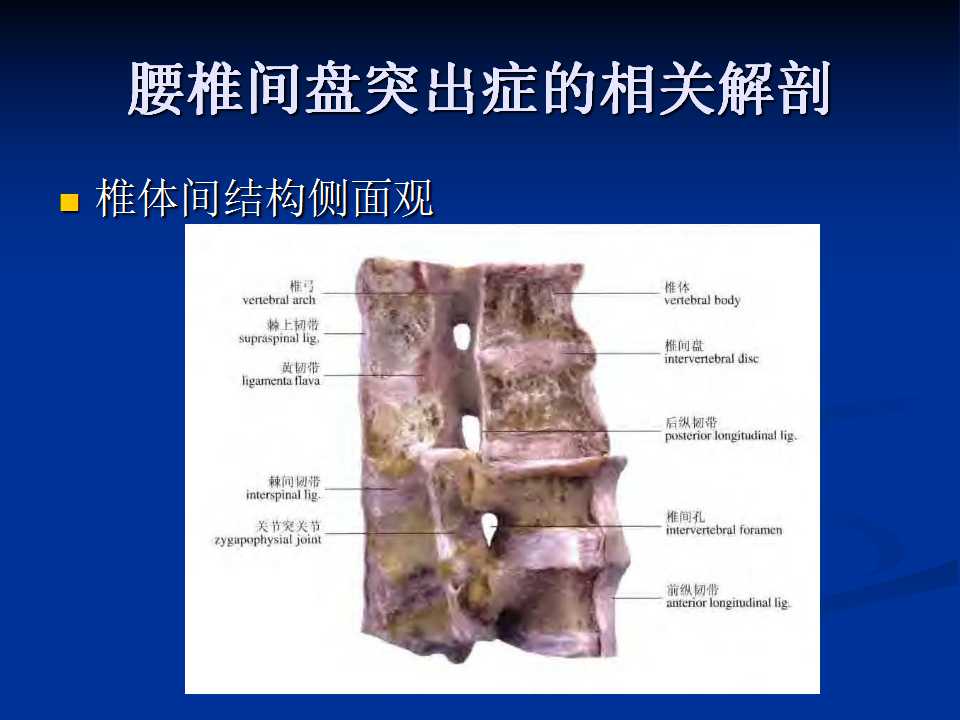 腰椎间盘突出症的鉴别诊断要点