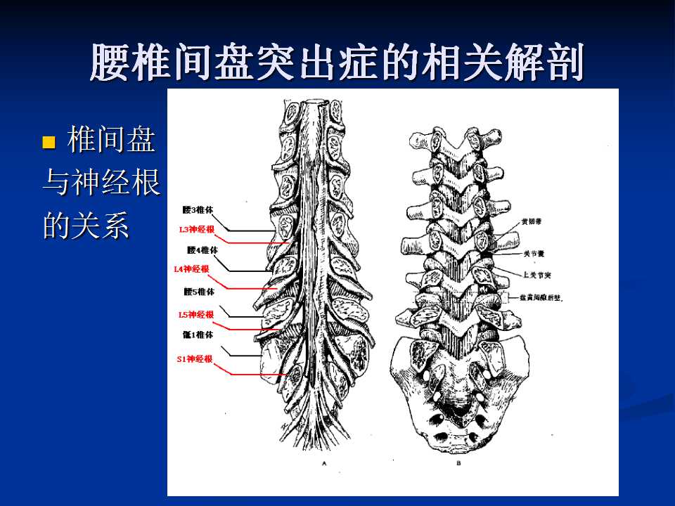 腰椎间盘突出症的鉴别诊断要点