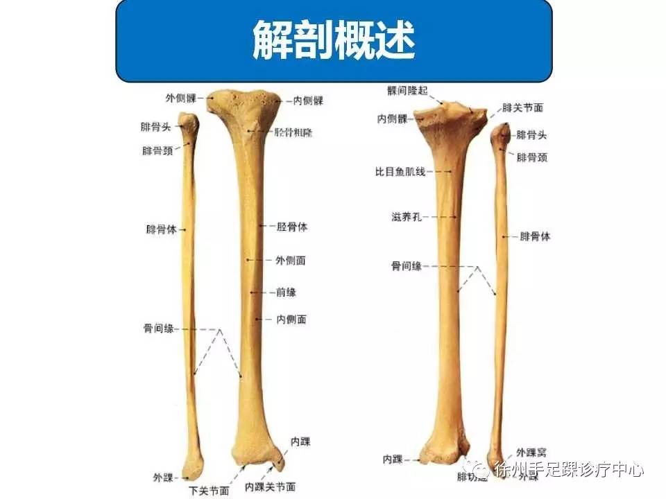 胫骨干骨折的诊断及治疗要点