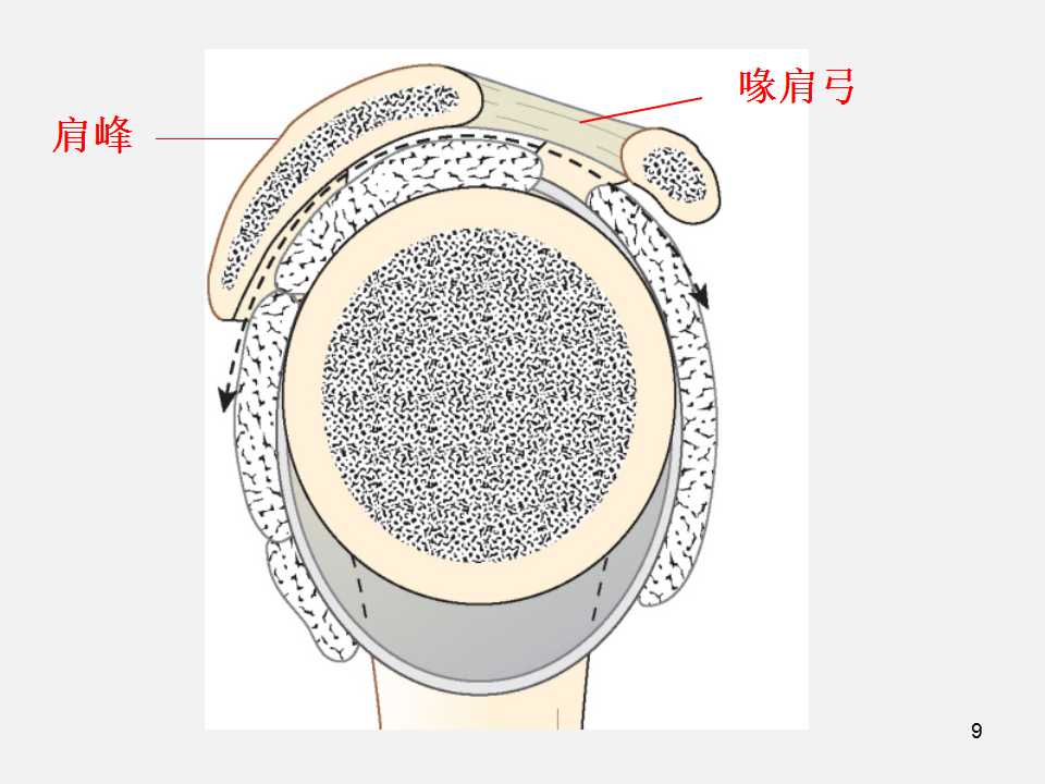 肩袖损伤的诊断与治疗技巧