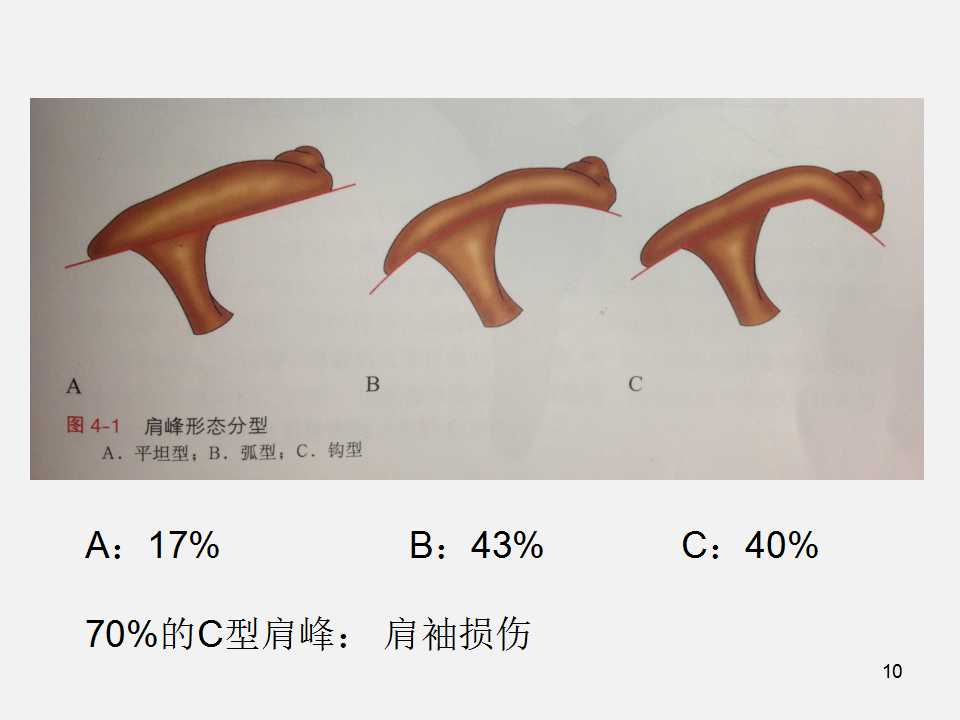 肩袖损伤的诊断与治疗技巧