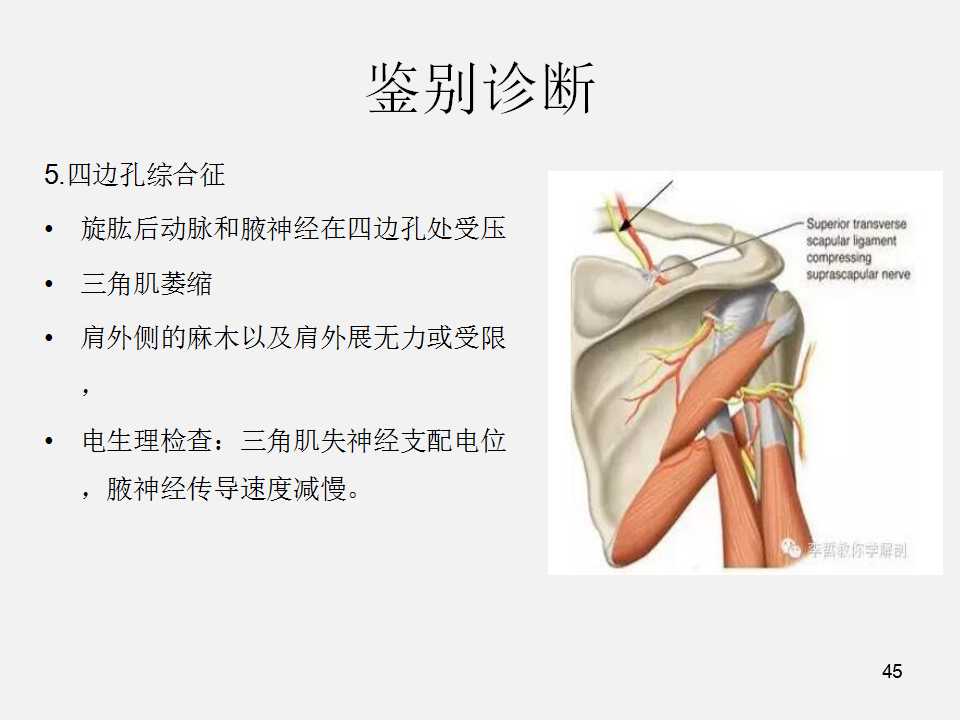 肩袖损伤的诊断与治疗技巧