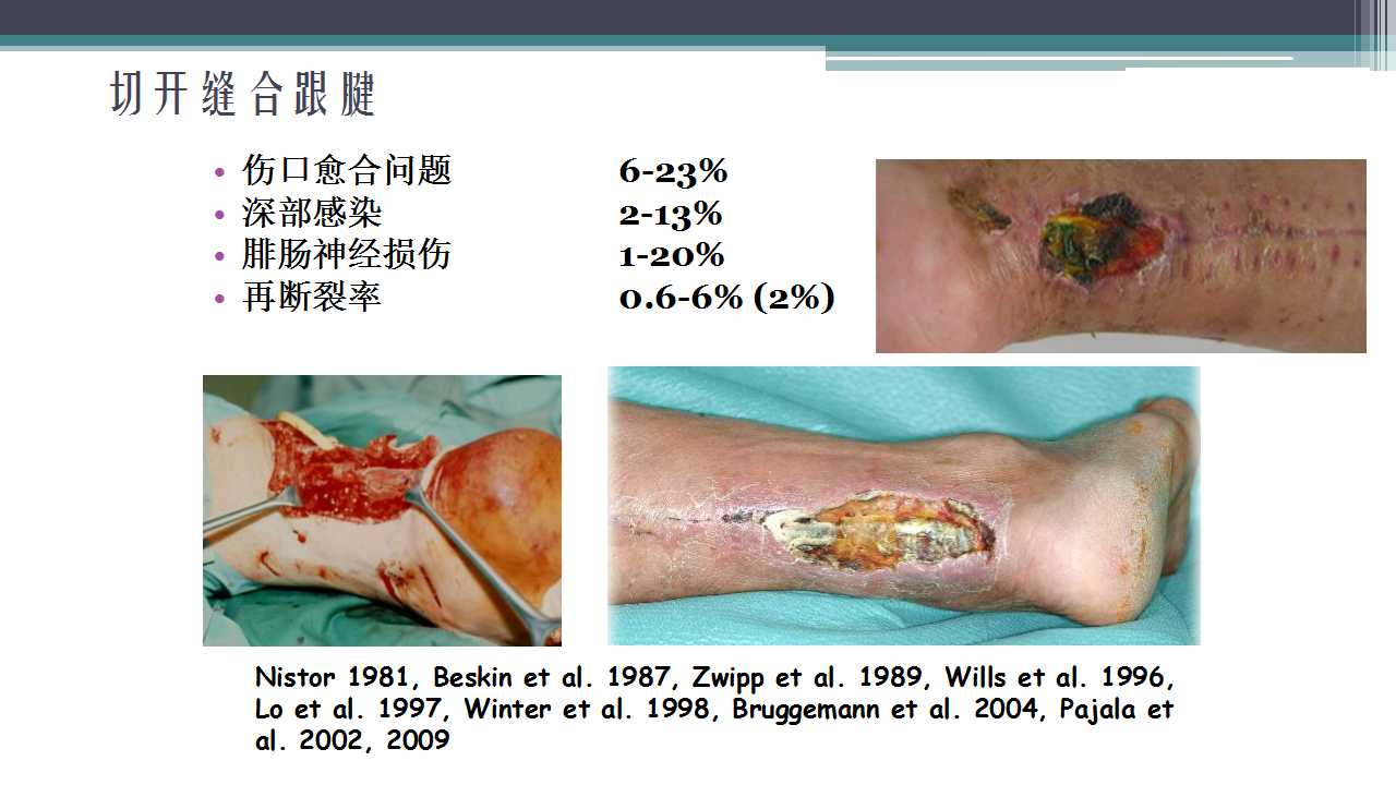 跟腱断裂治疗存在的问题及解决策略