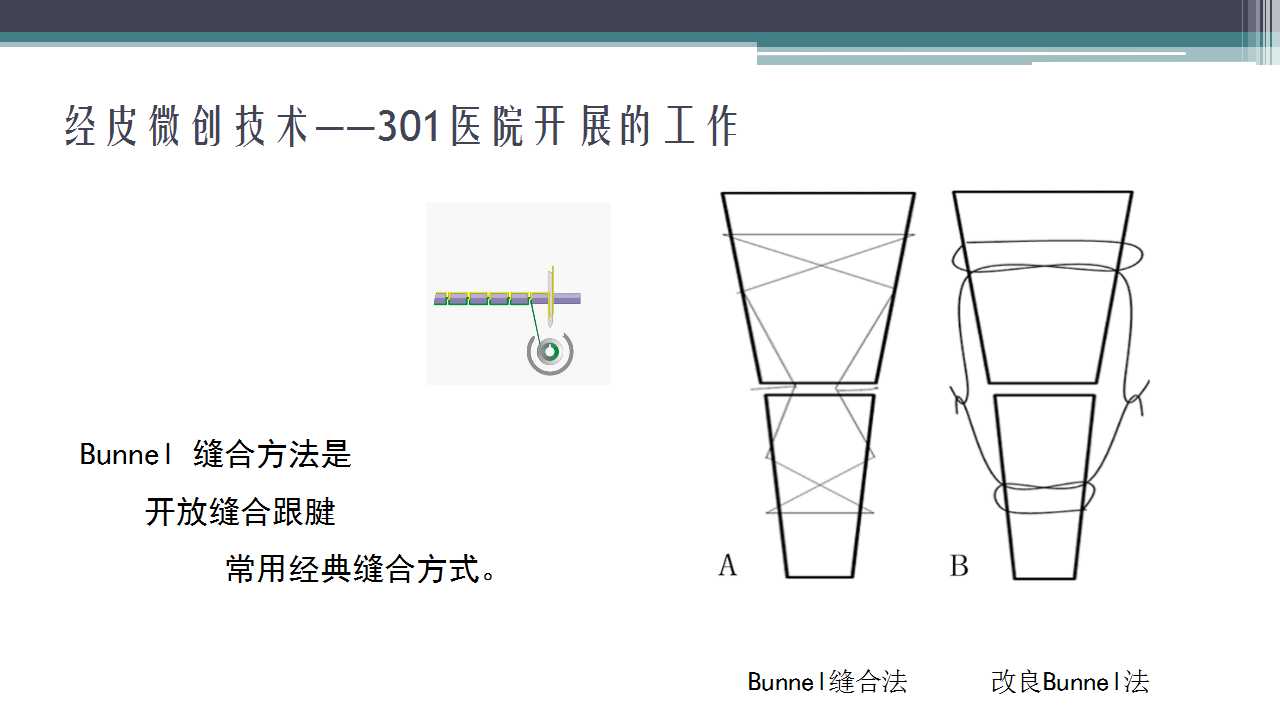 跟腱断裂治疗存在的问题及解决策略